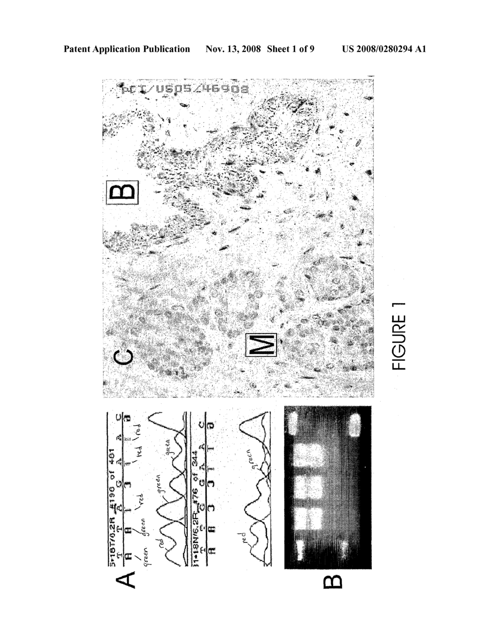 Inherited Mitochondrial Dna Mutations in Cancer - diagram, schematic, and image 02