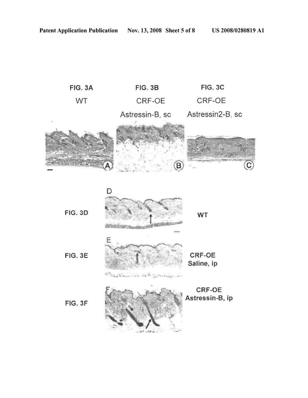 METHODS FOR PROMOTING HAIR GROWTH - diagram, schematic, and image 06