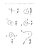 TRANSOBTURATOR INTRODUCER SYSTEM FOR SLING SUSPENSION SYSTEM diagram and image