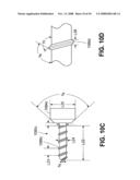 TRANSOBTURATOR INTRODUCER SYSTEM FOR SLING SUSPENSION SYSTEM diagram and image