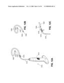 TRANSOBTURATOR INTRODUCER SYSTEM FOR SLING SUSPENSION SYSTEM diagram and image