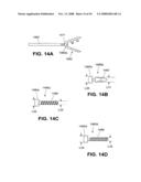 TRANSOBTURATOR INTRODUCER SYSTEM FOR SLING SUSPENSION SYSTEM diagram and image