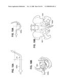 TRANSOBTURATOR INTRODUCER SYSTEM FOR SLING SUSPENSION SYSTEM diagram and image