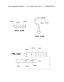 TRANSOBTURATOR INTRODUCER SYSTEM FOR SLING SUSPENSION SYSTEM diagram and image