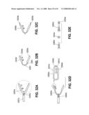 TRANSOBTURATOR INTRODUCER SYSTEM FOR SLING SUSPENSION SYSTEM diagram and image