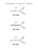 TRANSOBTURATOR INTRODUCER SYSTEM FOR SLING SUSPENSION SYSTEM diagram and image