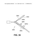 TRANSOBTURATOR INTRODUCER SYSTEM FOR SLING SUSPENSION SYSTEM diagram and image