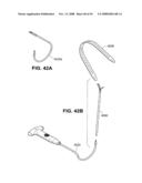 TRANSOBTURATOR INTRODUCER SYSTEM FOR SLING SUSPENSION SYSTEM diagram and image