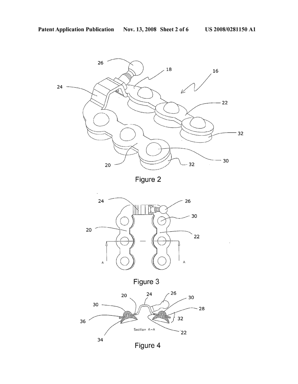 Suction Cup Epicardial Stabilizer Device for Cardiac Surgery - diagram, schematic, and image 03