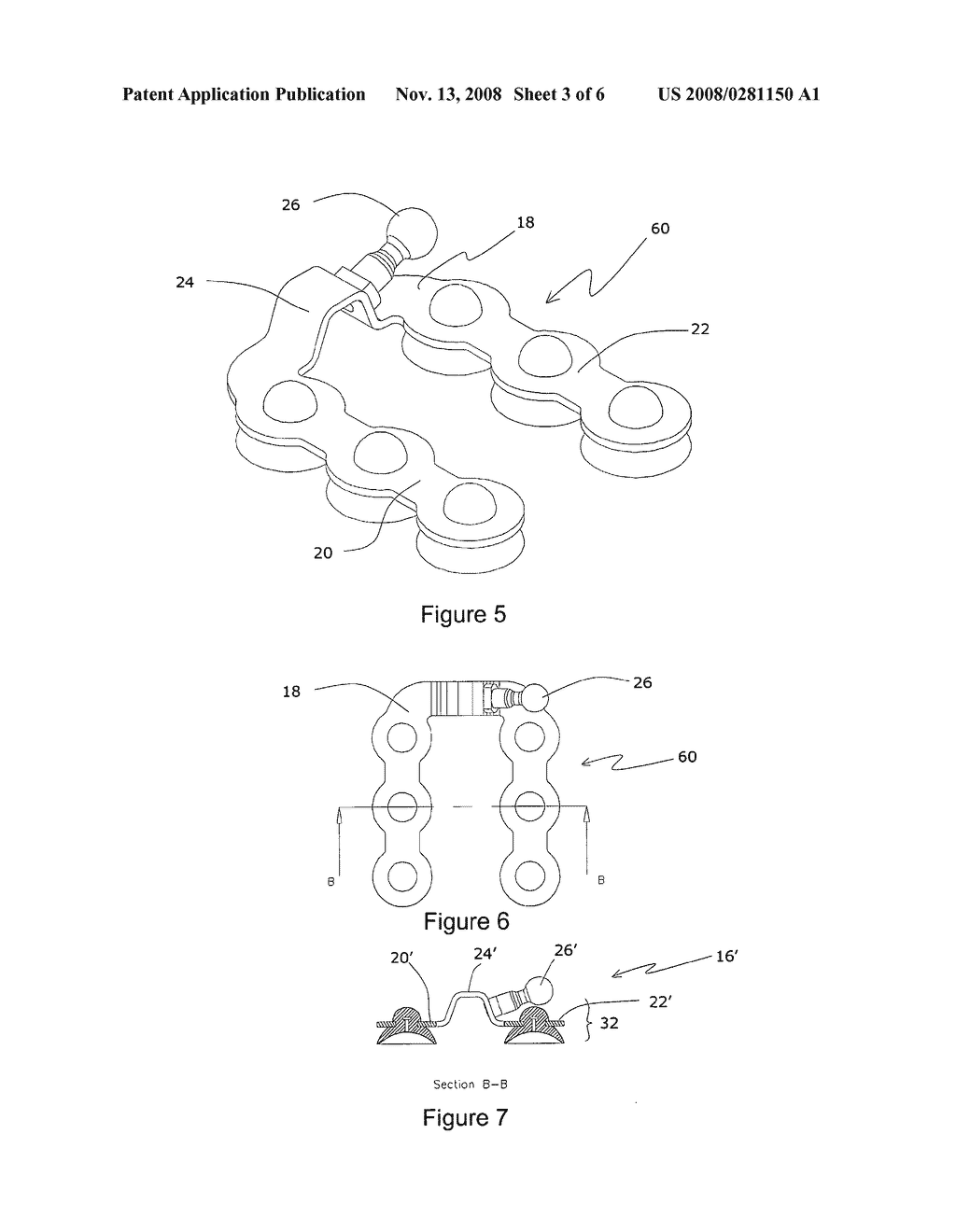 Suction Cup Epicardial Stabilizer Device for Cardiac Surgery - diagram, schematic, and image 04