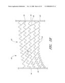 HEART FAILURE TREATMENT DEVICE AND METHOD diagram and image