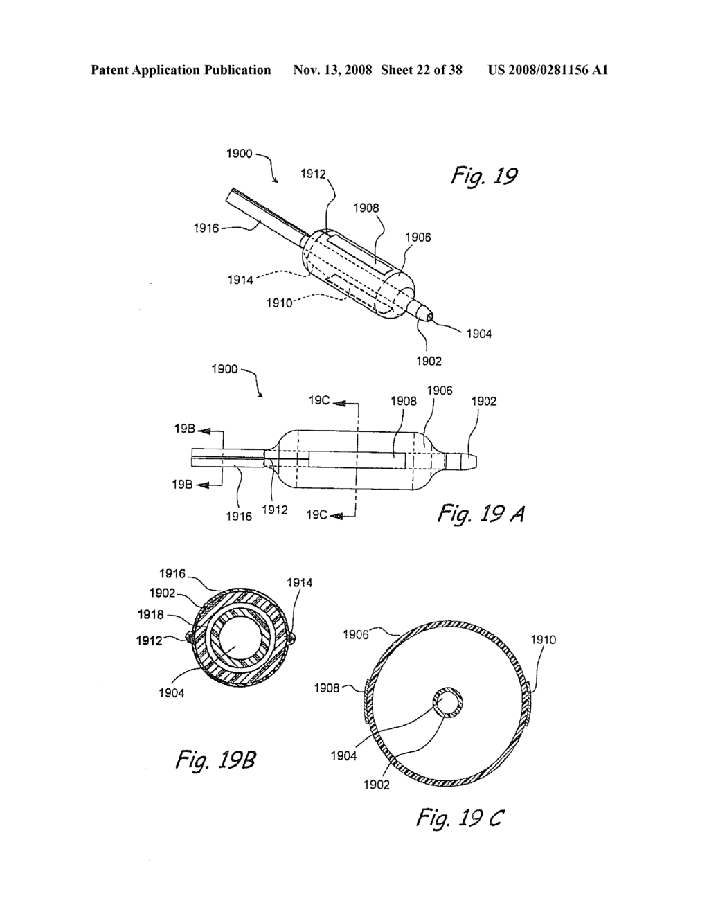 Methods and Apparatus for Treating Disorders of the Ear Nose and Throat - diagram, schematic, and image 23