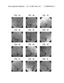 Combination of Multi-Modality Imaging Technologies diagram and image