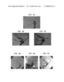 Combination of Multi-Modality Imaging Technologies diagram and image