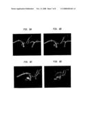 Combination of Multi-Modality Imaging Technologies diagram and image