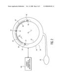 Transducer Cuff for Guidance and Application of High Intensity Focused Ultrasound for Control of Bleeding Due to Severed Limbs diagram and image