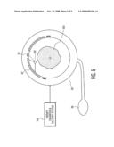 Transducer Cuff for Guidance and Application of High Intensity Focused Ultrasound for Control of Bleeding Due to Severed Limbs diagram and image