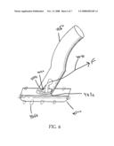 Valves and Conduits for Vascular Access diagram and image