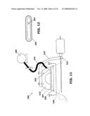 Needle Delivery System for Electrodes diagram and image