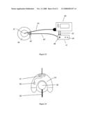 Method and device for drug delivery diagram and image