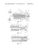 DETACHABLE ANEURYSM NECK BRIDGE diagram and image