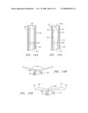 DETACHABLE ANEURYSM NECK BRIDGE diagram and image