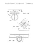 DETACHABLE ANEURYSM NECK BRIDGE diagram and image