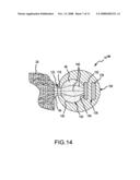 Treatment and diagnostic catheters with hydrogel electrodes diagram and image