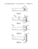 Treatment and diagnostic catheters with hydrogel electrodes diagram and image