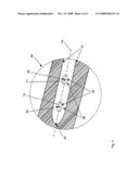 Method and Device for Computer Assisted Distal Locking of Intramedullary Nails diagram and image