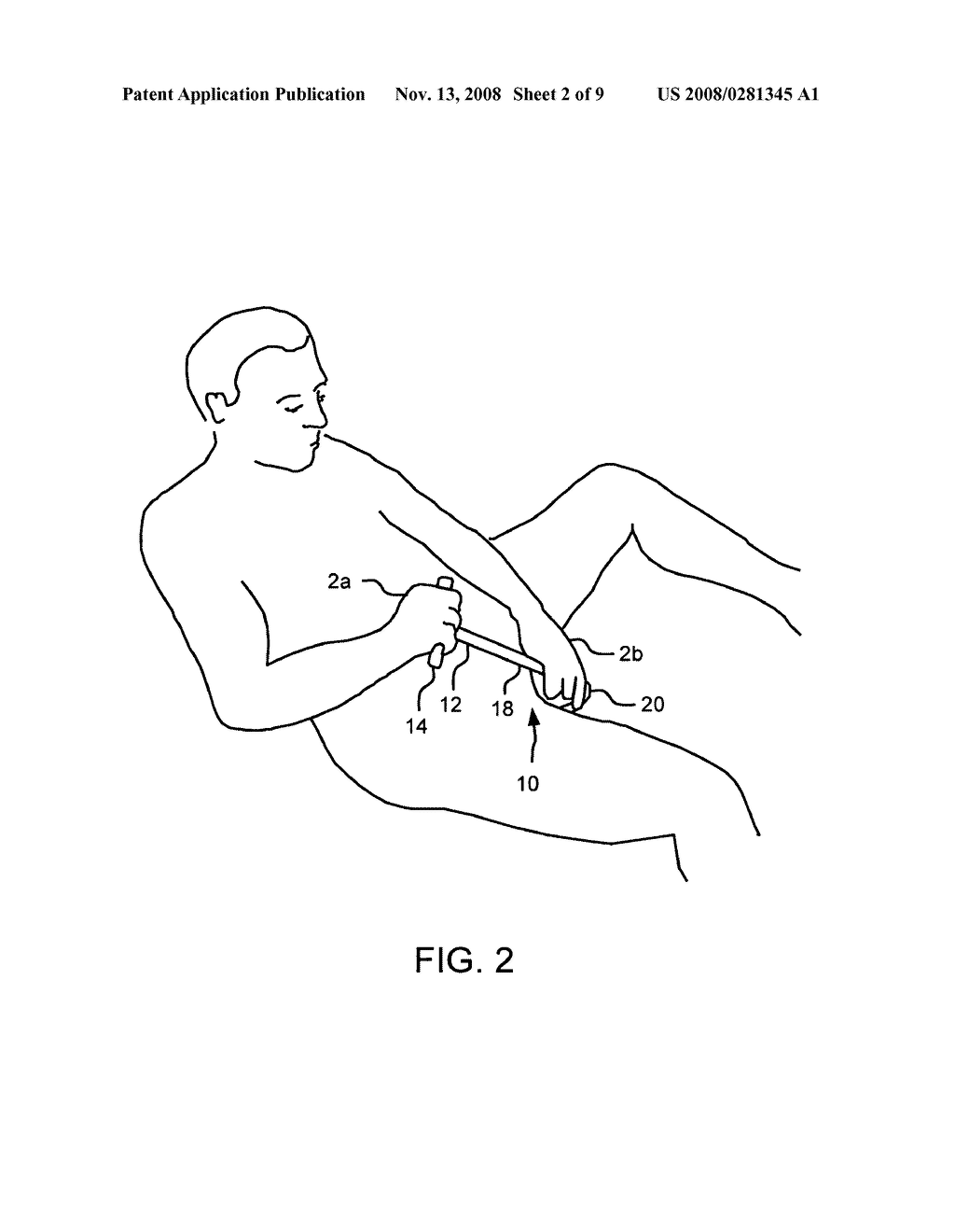 METHOD AND APPARATUS FOR TREATING PELVIC PAIN - diagram, schematic, and image 03