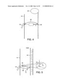 Treatment Apparatus for Applying Electrical Impulses to the Body of a Patient diagram and image