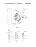 Systems and methods for treating body tissue diagram and image