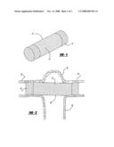 Covered stent having a dissolvable portion diagram and image