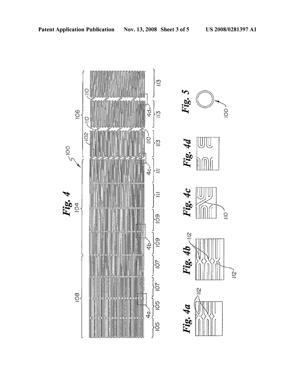 STENT HAVING VARIABLE PROPERTIES AND METHOD OF ITS USE - diagram, schematic, and image 04