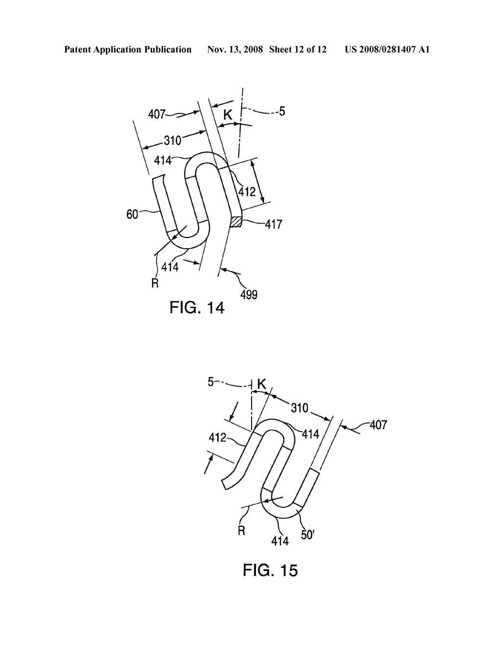 STENT HAVING HELICAL ELEMENTS - diagram, schematic, and image 13