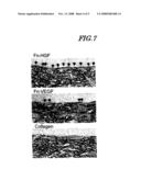 Artificial Blood Vessel diagram and image