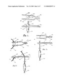 Electric Fishing Device diagram and image