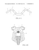 COMBINED STRUCTURE OF THE TUBULAR HANDLE diagram and image