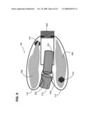 Gentle touch surgical stapler diagram and image