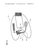 Gentle touch surgical stapler diagram and image