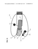 Gentle touch surgical stapler diagram and image