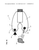 Gentle touch surgical stapler diagram and image