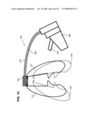 Gentle touch surgical stapler diagram and image