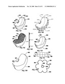 Temperature-Compensated Airbag Inflator diagram and image