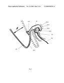 ANTI-WHIPLASH VEHICLE SEAT diagram and image