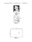 Contrast enhancement methods and apparatuses diagram and image