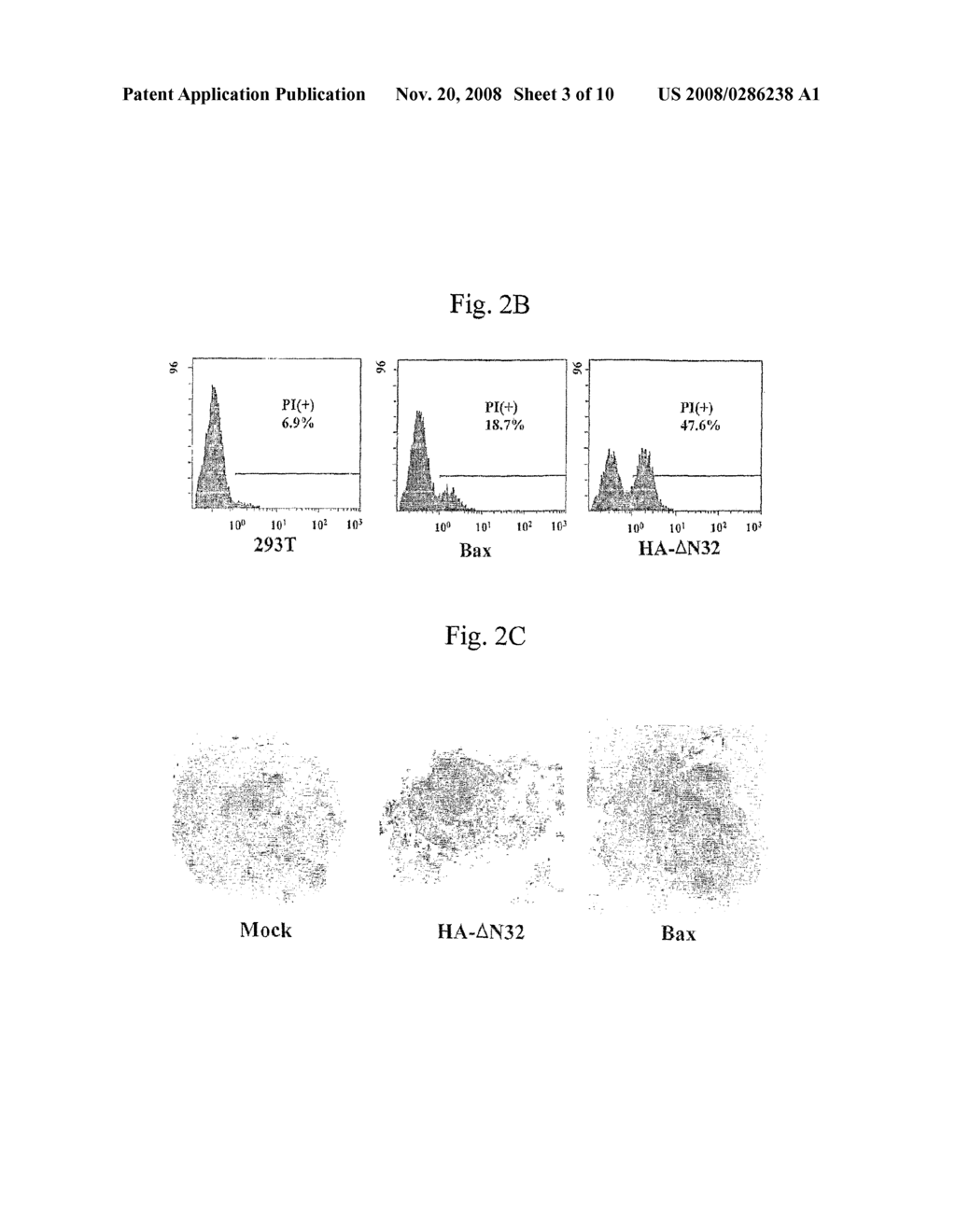 Recombinant Adenovirus Expressing A Gene Encoding Streptolysin O Proetin and Anti-Cancer Composition Comprising Same - diagram, schematic, and image 04