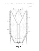 PROCESSED ECM MATERIALS WITH ENHANCED COMPONENT PROFILES diagram and image