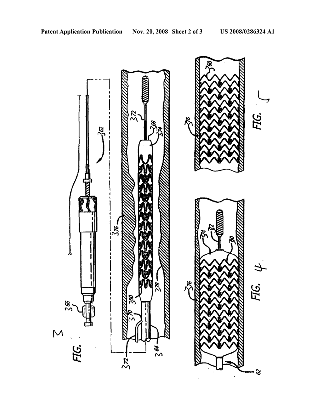 MEDIA AND DEVICES FOR COLD STORAGE OF THERAPEUTIC CELLS - diagram, schematic, and image 03